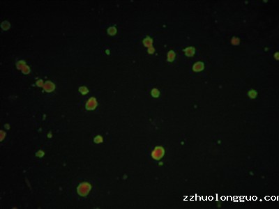 膜免疫荧光法检测血清水痘