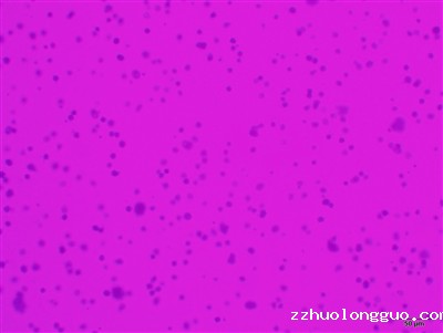 软琼脂克隆